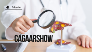 Read more about the article Cagaarshow