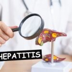 Hepatitis