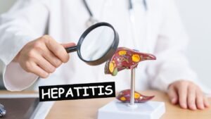 Read more about the article Hepatitis